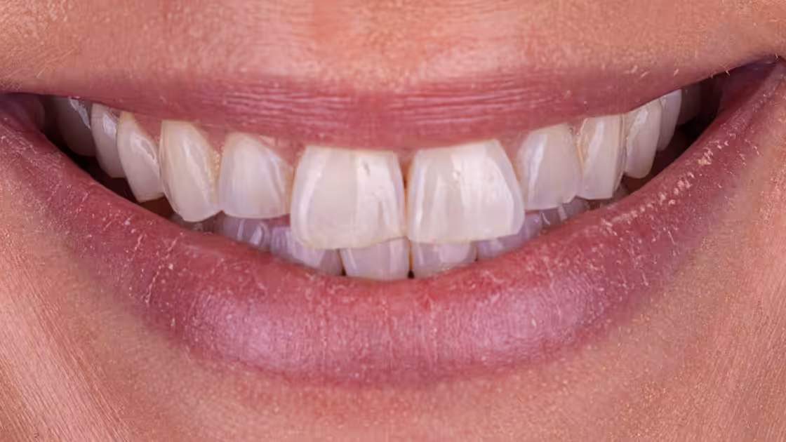 Case 6-BEFORE-SMILE