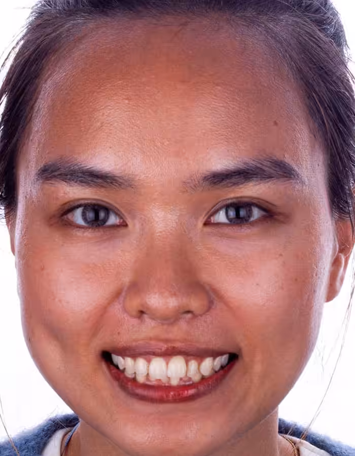Case 3 before face