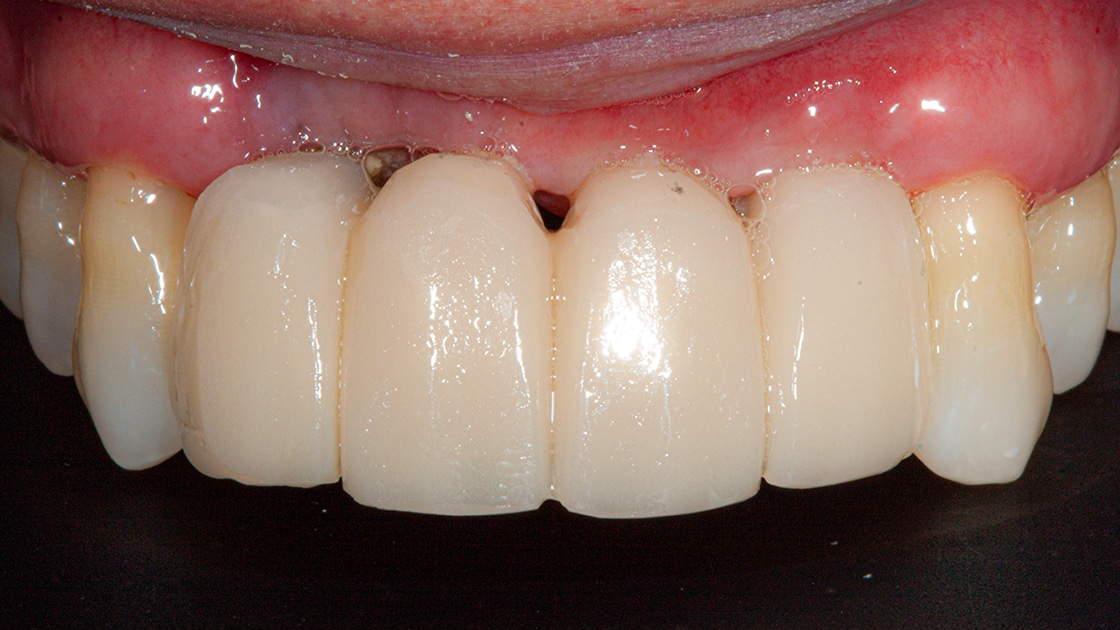 Case 2 Tissue Development