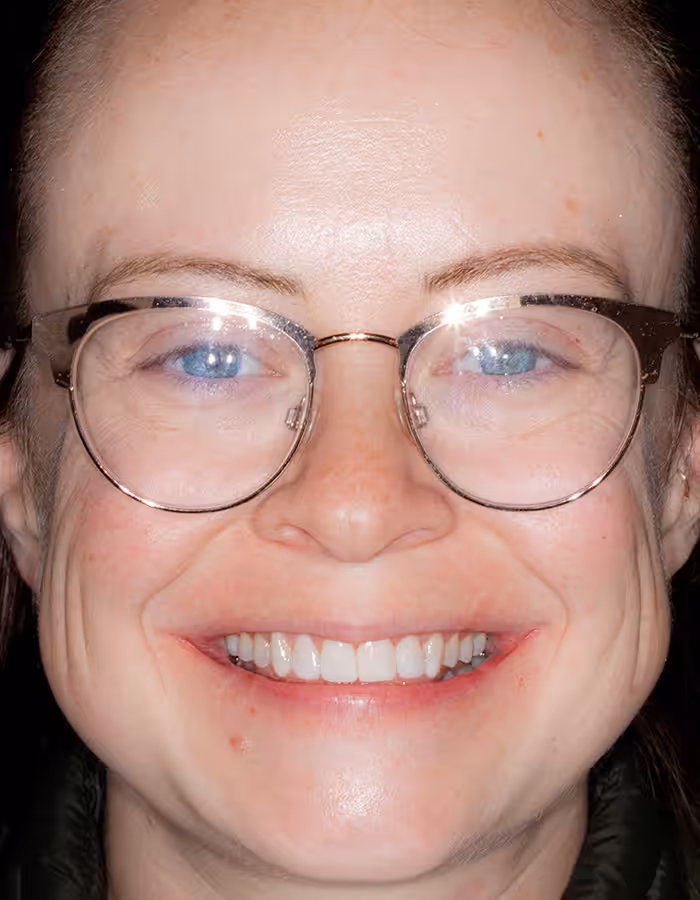 Actual Patient after face