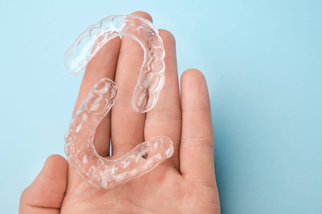 Can Invisalign Fix an Overbite?