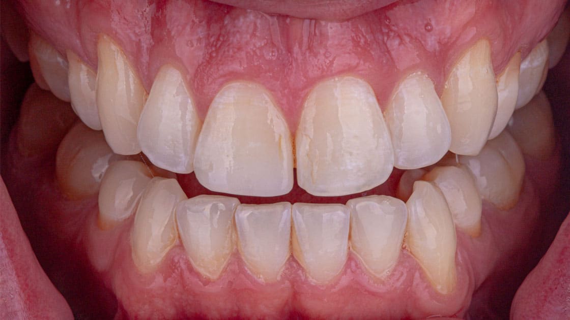 chris-teeth-before