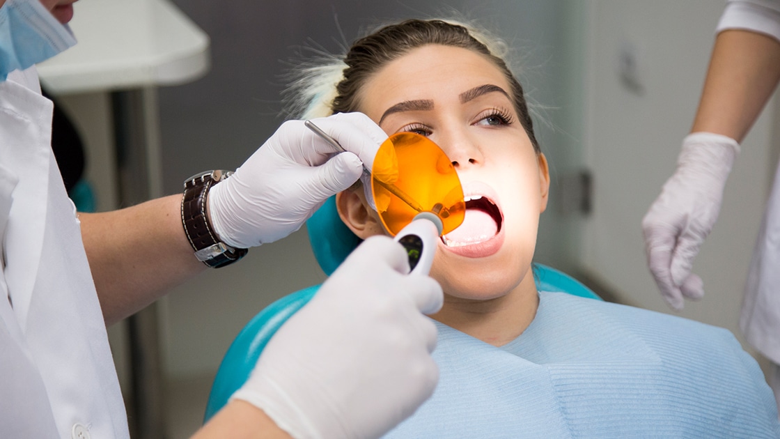 Dental Fillings