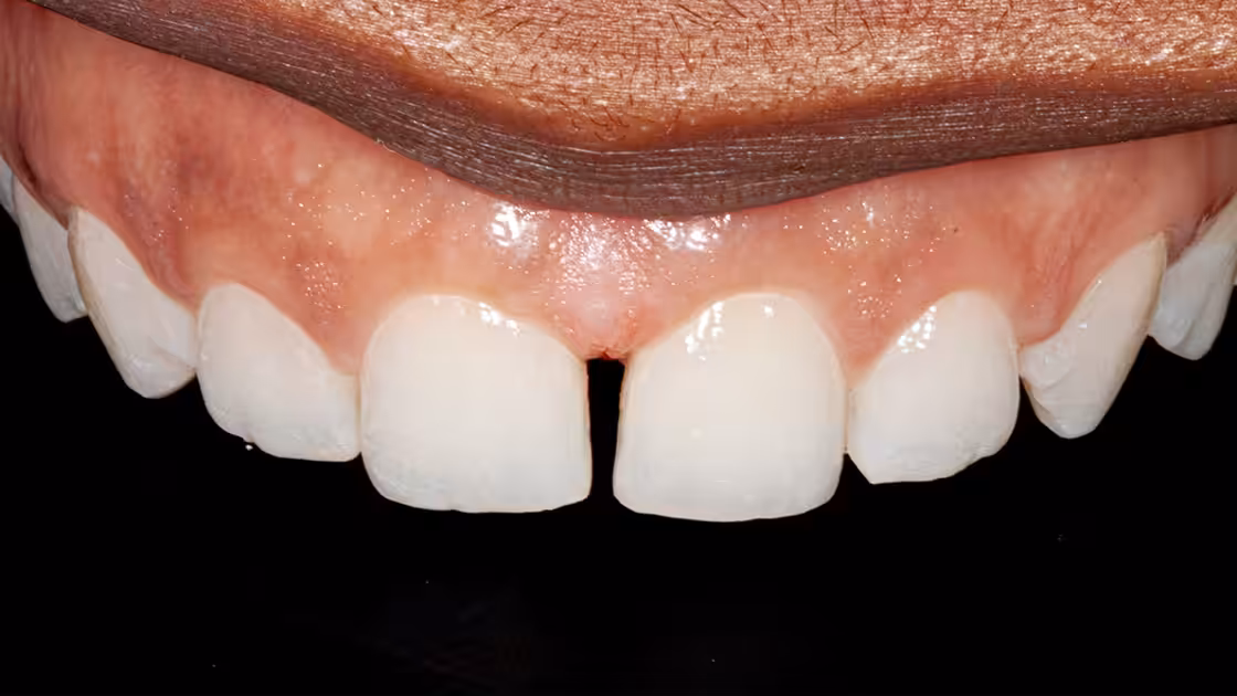Periodontics photo