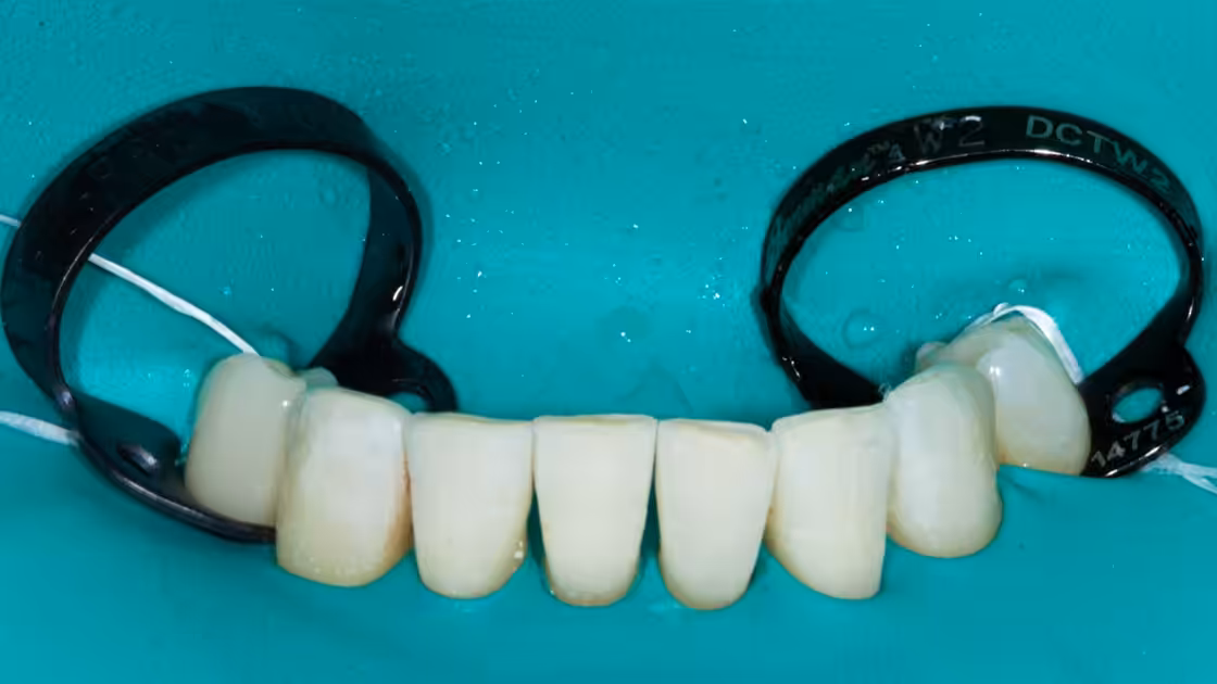General dentistry decorative image