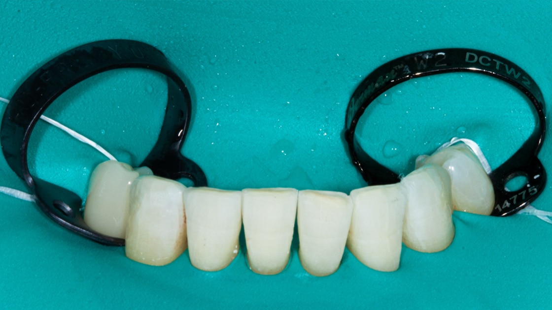 General dentistry decorative image