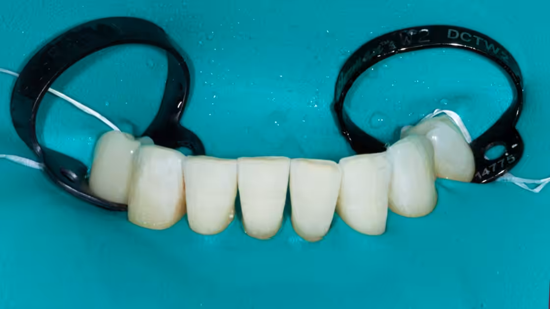 Preventive Dentistry photo