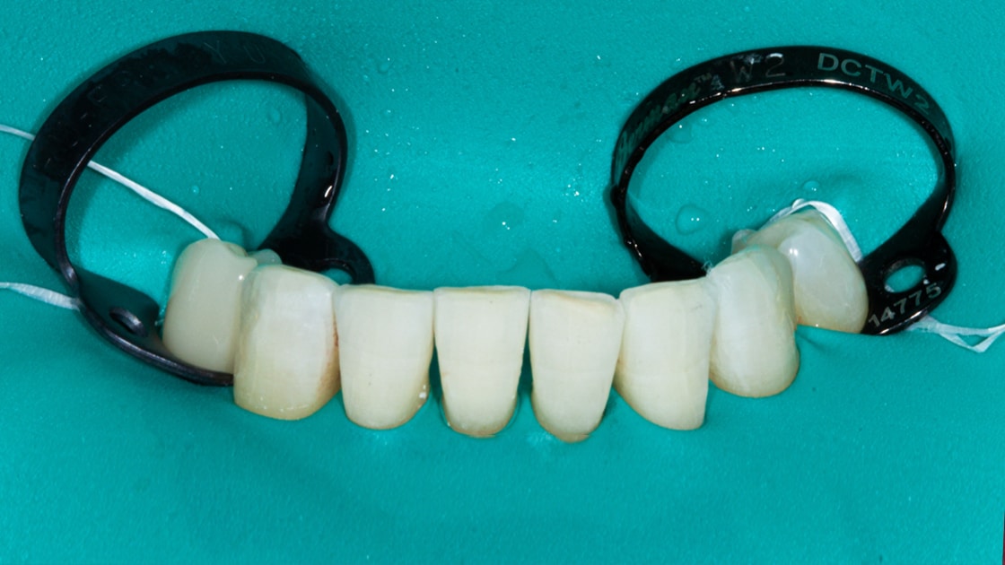 Preventive Dentistry photo