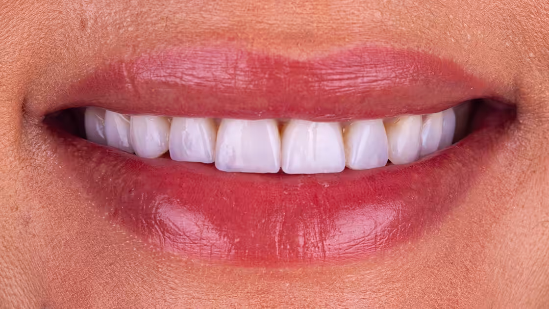 Cosmetic Dentistry