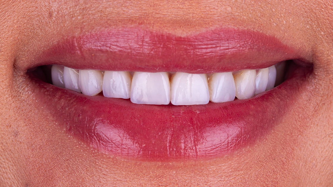 Cosmetic Dentistry