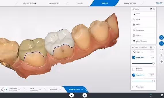 CAD/CAM Restorations