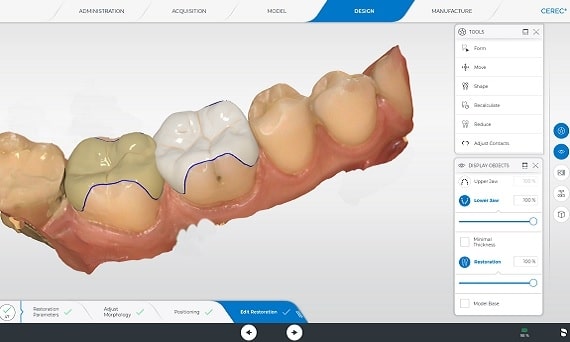 CAD/CAM Restorations